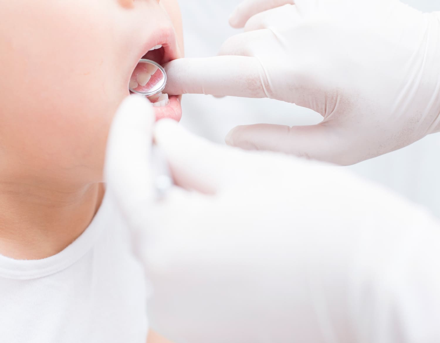 噛む喜びを患者様に提供する口腔外科医によるインプラント治療