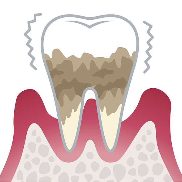 歯周病のことでお悩みの方